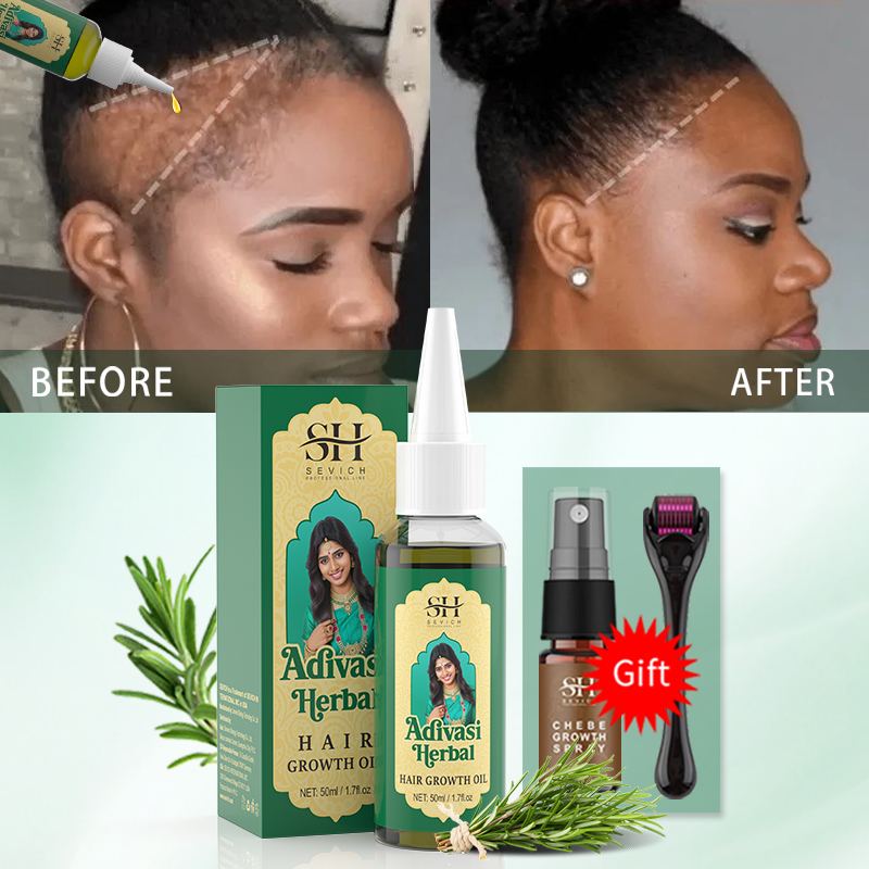 Ayurvedic Hair Growth Oil Indi - огляд і ціна Hair Care Essence Oil Spray