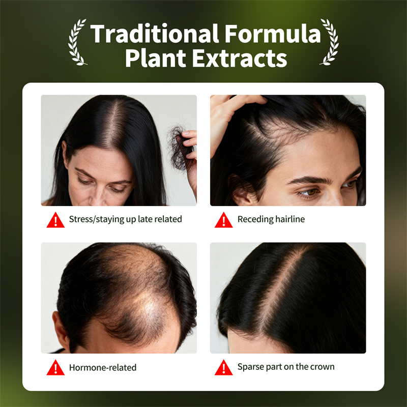 Natural Hair Growth Set Usman  - огляд і ціна Hair Care Essence Oil Spray