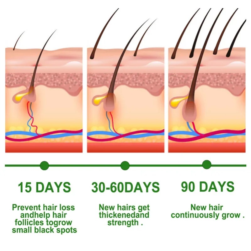 Hair Growth Serum Fast Growing - огляд і ціна Hair Care Essence Oil Spray