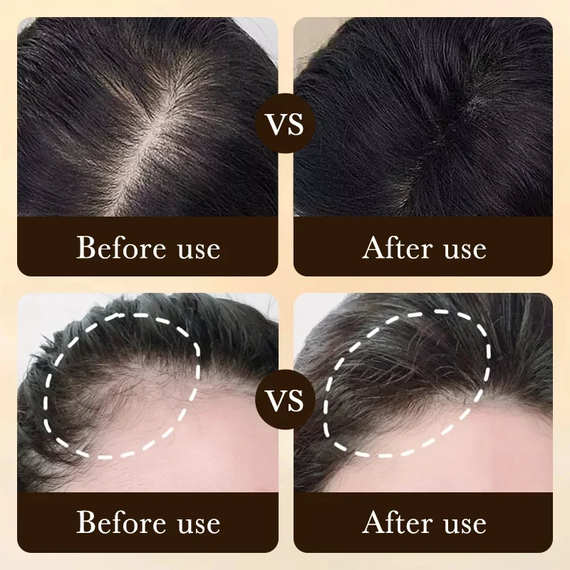 Biotin Fast Hair Growth Oil Pr - огляд і ціна Hair Care Essence Oil Spray