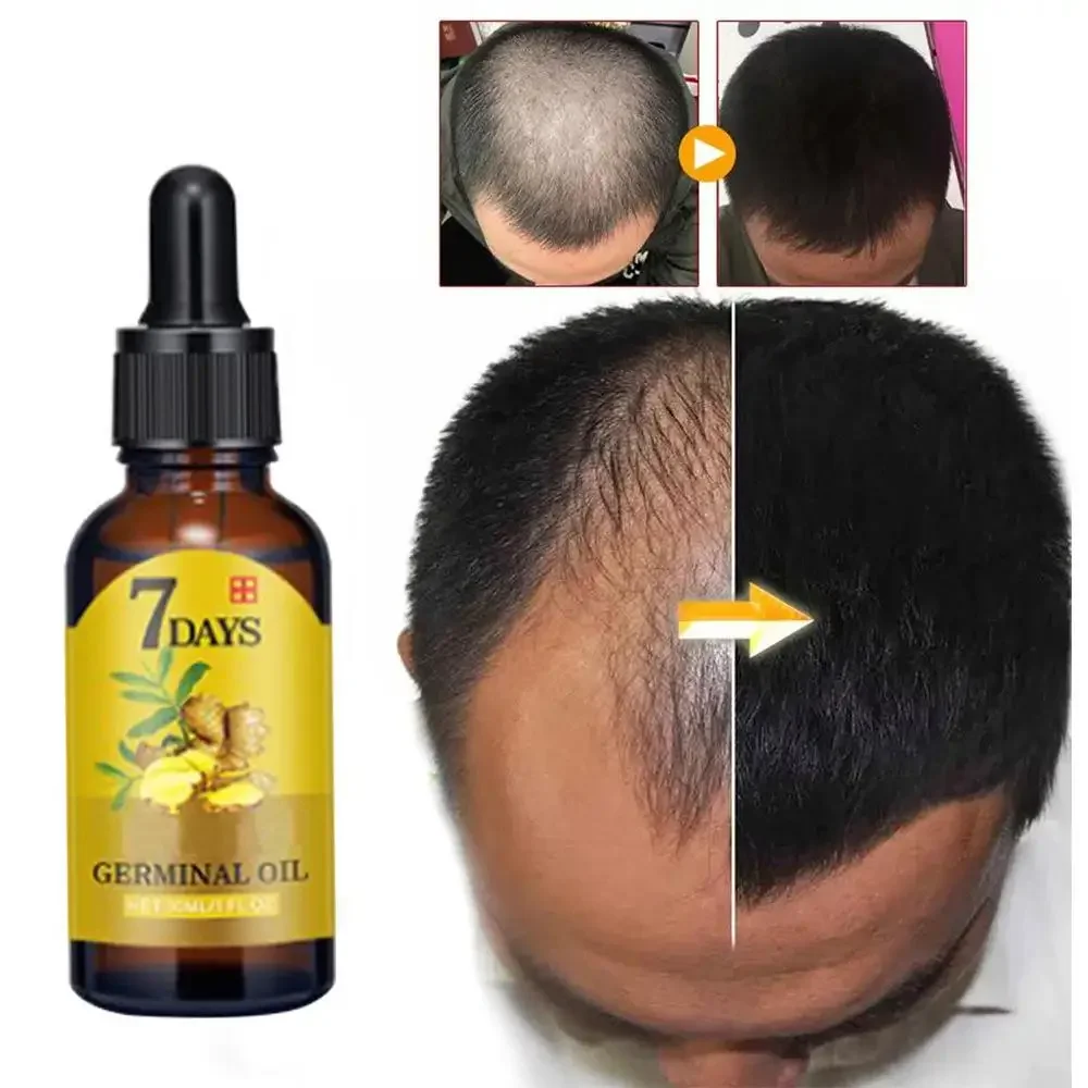Hair Growth Ginger Fast Growin - огляд і ціна Hair Care Essence Oil Spray
