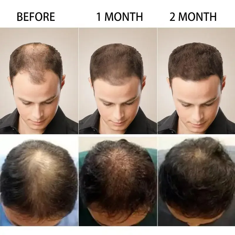 Hair Growth Ginger Fast Growin - огляд і ціна Hair Care Essence Oil Spray